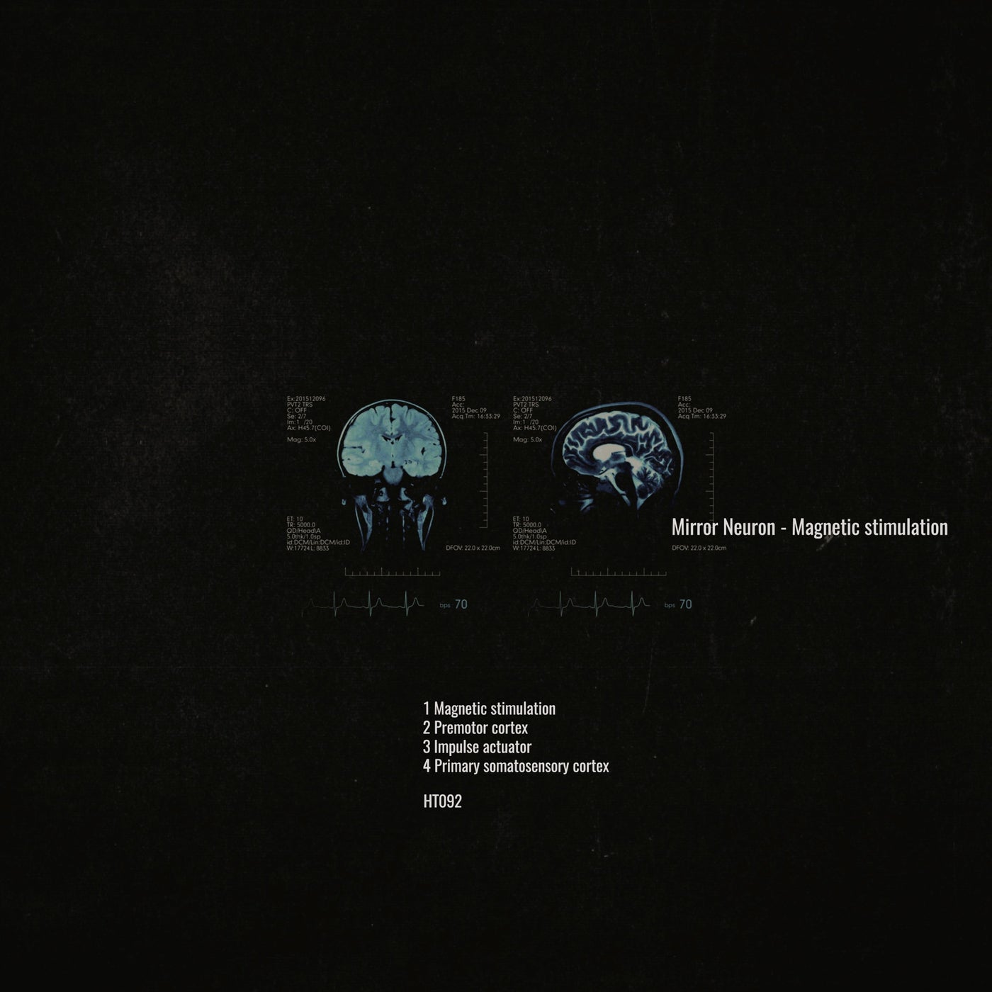 Mirror Neuron – Primary Somatosensory Cortex (Original Mix)